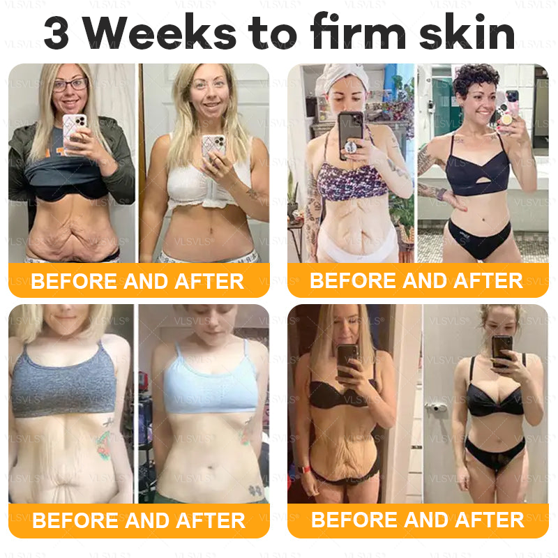 VLSVLS® Bee Venom Comprehensive Cream  🇨🇦🇨🇦LAST DAY 80% OFF🌟 (Sagging Skin, Fine Lines, Loss of Firmness, Flat Bust, Drooping Hips, and More)
