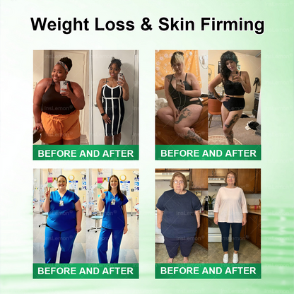 𝐂𝐞𝐫𝐭𝐢𝐟𝐢𝐞𝐝 𝐐𝐮𝐚𝐥𝐢𝐭𝐲 𝐒𝐭𝐚𝐧𝐝𝐚𝐫𝐝𝐬 & 𝐆𝐌𝐏 𝐂𝐞𝐫𝐭𝐢𝐟𝐢𝐞𝐝 🔥| 𝐈𝐧𝐬𝐋𝐞𝐦𝐨𝐧® 𝗠𝗼𝗿𝗶𝗻𝗴𝗮 × 𝗕𝗲𝗿𝗯𝗲𝗿𝗶𝗻𝗲 × 𝗔𝗠𝗣𝗞 𝟭𝟬-𝗶𝗻-𝟭 𝗠𝗲𝘁𝗮𝗯𝗼𝗹𝗶𝗰 𝗦𝘂𝗽𝗽𝗼𝗿𝘁 𝗡𝗮𝗻𝗼 𝗠𝗶𝗰𝗿𝗼𝗻𝗲𝗲𝗱𝗹𝗲 𝗣𝗮𝘁𝗰𝗵🇨🇦(𝐉𝐮𝐬𝐭 𝐨𝐧𝐜𝐞 𝐚 𝐝𝐚𝐲, 𝐯𝐢𝐬𝐢𝐛𝐥𝐞 𝐜𝐡𝐚𝐧𝐠𝐞𝐬 𝐢𝐧 𝟕 𝐝𝐚𝐲𝐬） ✅ 𝐅𝐨𝐫 𝐨𝐛𝐞𝐬𝐢𝐭𝐲, 🅛🅞🅞🅢🅔 🅢🅚🅘🅝,𝐝𝐢𝐚𝐛𝐞𝐭𝐞𝐬, 𝐬𝐥𝐞𝐞𝐩 𝐚𝐩𝐧𝐞𝐚, 𝐣𝐨𝐢𝐧𝐭 𝐢𝐬𝐬𝐮𝐞𝐬, 𝐚𝐧𝐝 𝐦𝐨𝐫𝐞