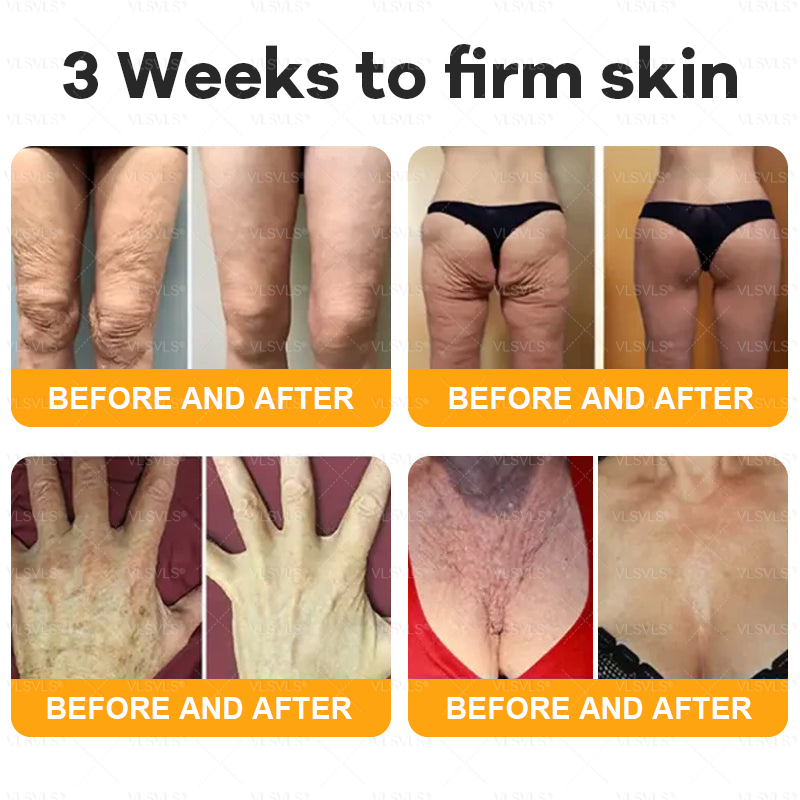 VLSVLS® Bee Venom Comprehensive Cream  🇨🇦🇨🇦LAST DAY 80% OFF🌟 (Sagging Skin, Fine Lines, Loss of Firmness, Flat Bust, Drooping Hips, and More)