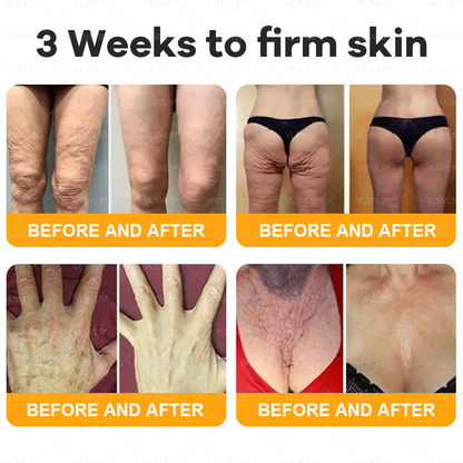 VLSVLS® Bee Venom Comprehensive Cream  🇨🇦🇨🇦LAST DAY 80% OFF🌟 (Sagging Skin, Fine Lines, Loss of Firmness, Flat Bust, Drooping Hips, and More)